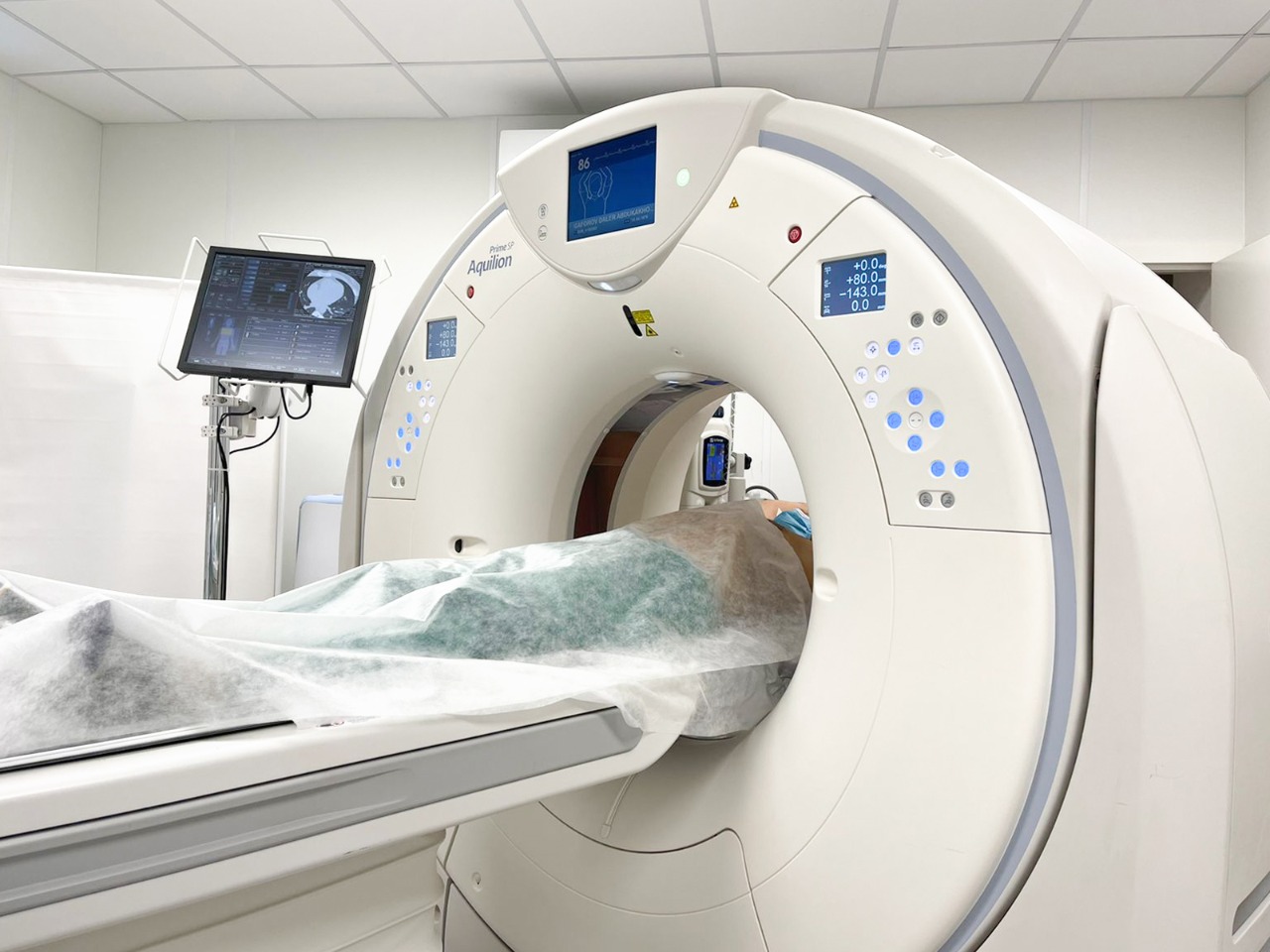 Быстро, точно и безопасно — компьютерная томография органов грудной клетки в Первой онкологической больнице Москвы | Городская клиническая онкологическая больница №1